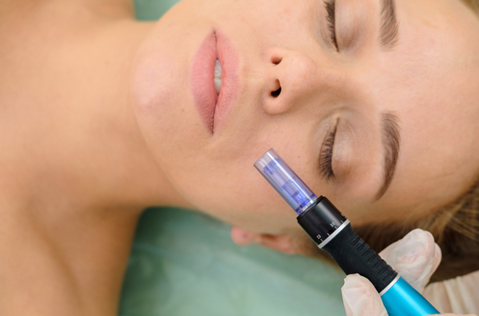 Radio frequency microneedling in Overland Park