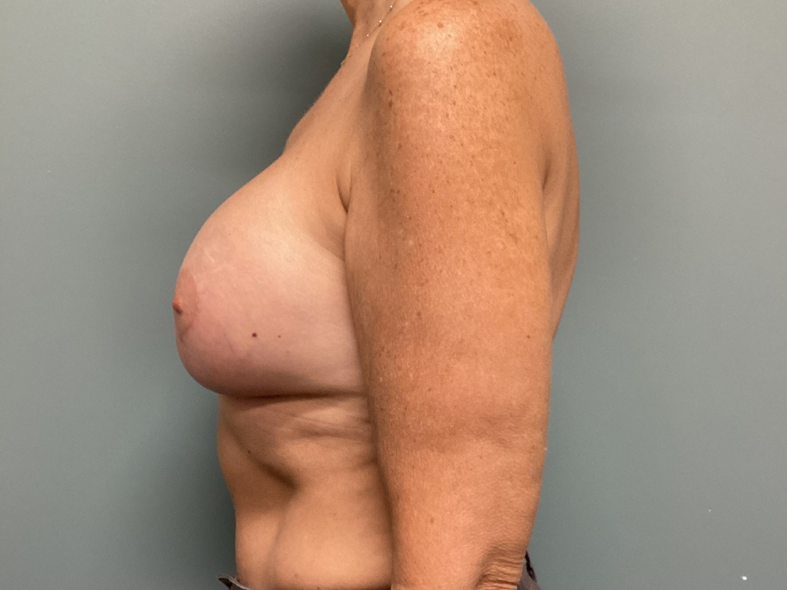 06.05.2025.EAK.BAM.Pexy.After_4