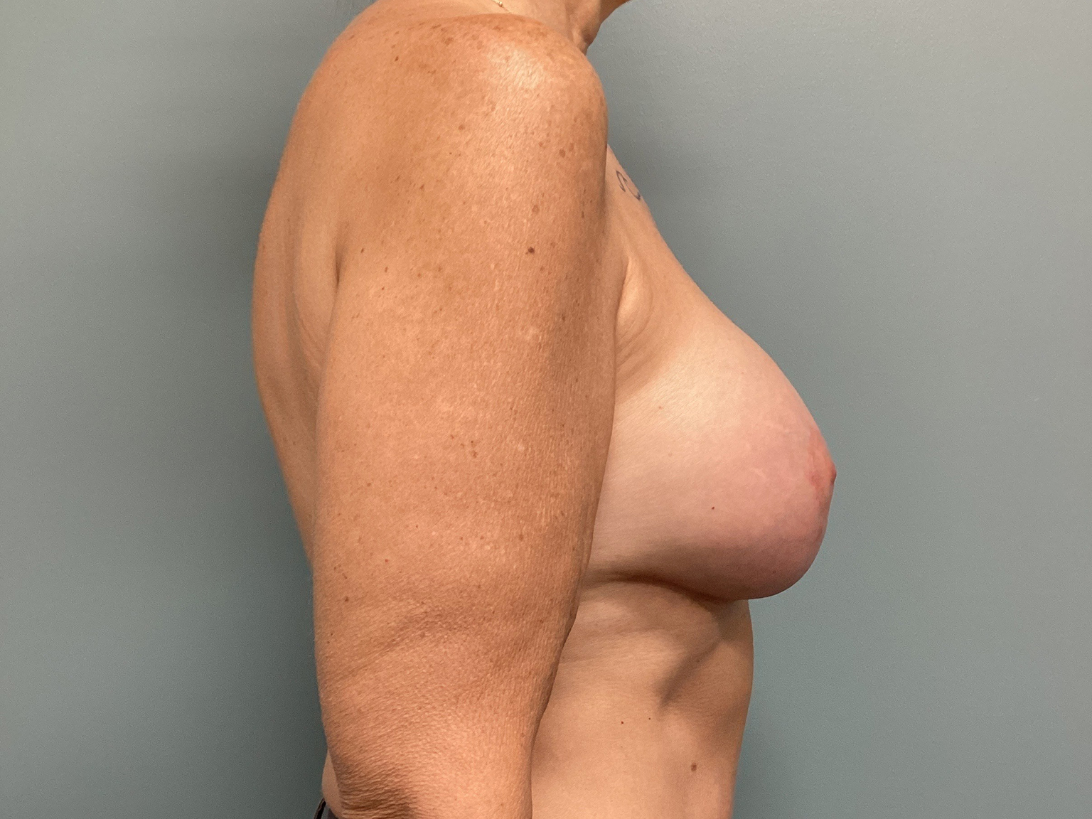 06.05.2025.EAK.BAM.Pexy.After_4