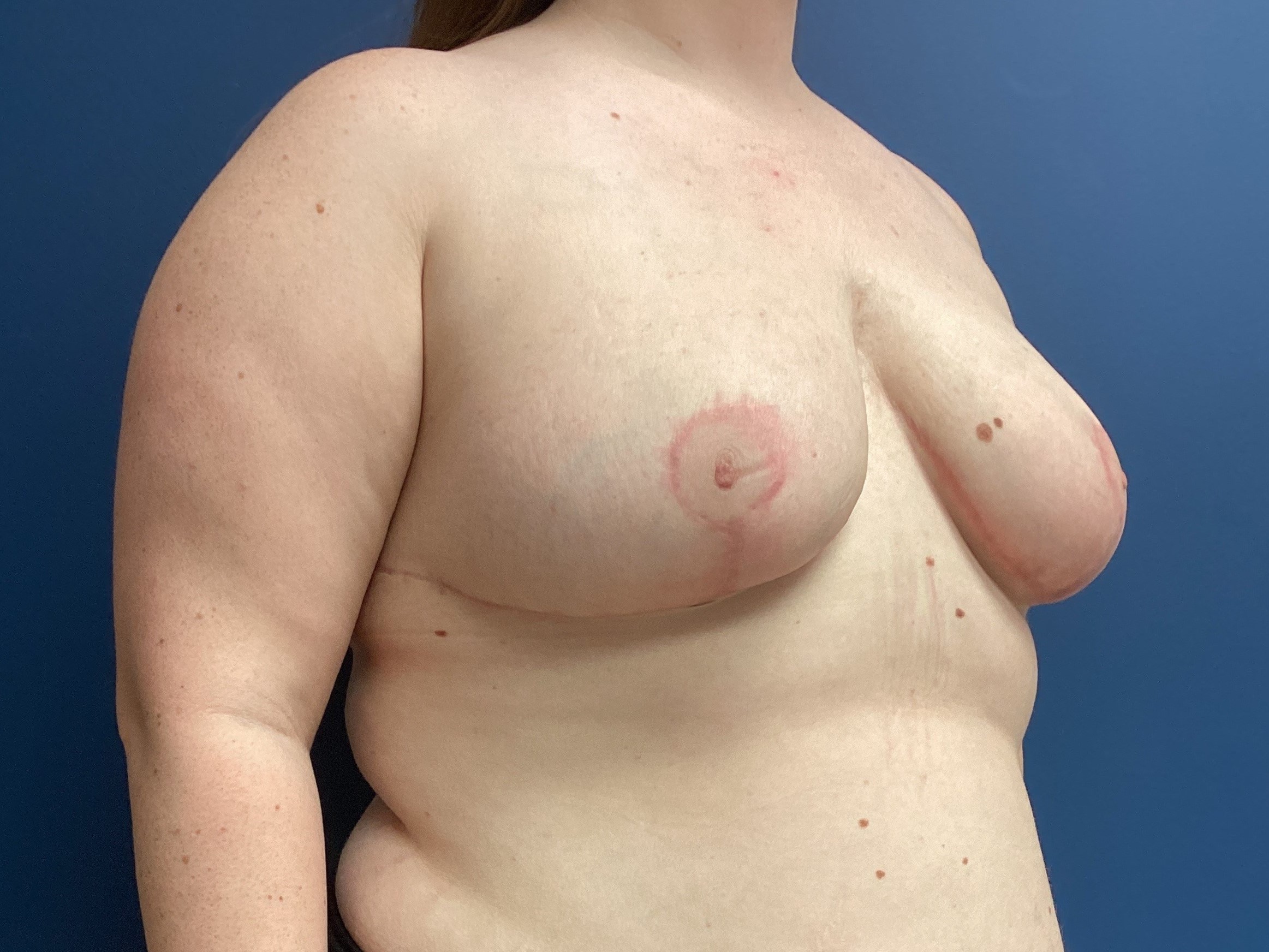 10.16.24_EAK_BRM_After (2)