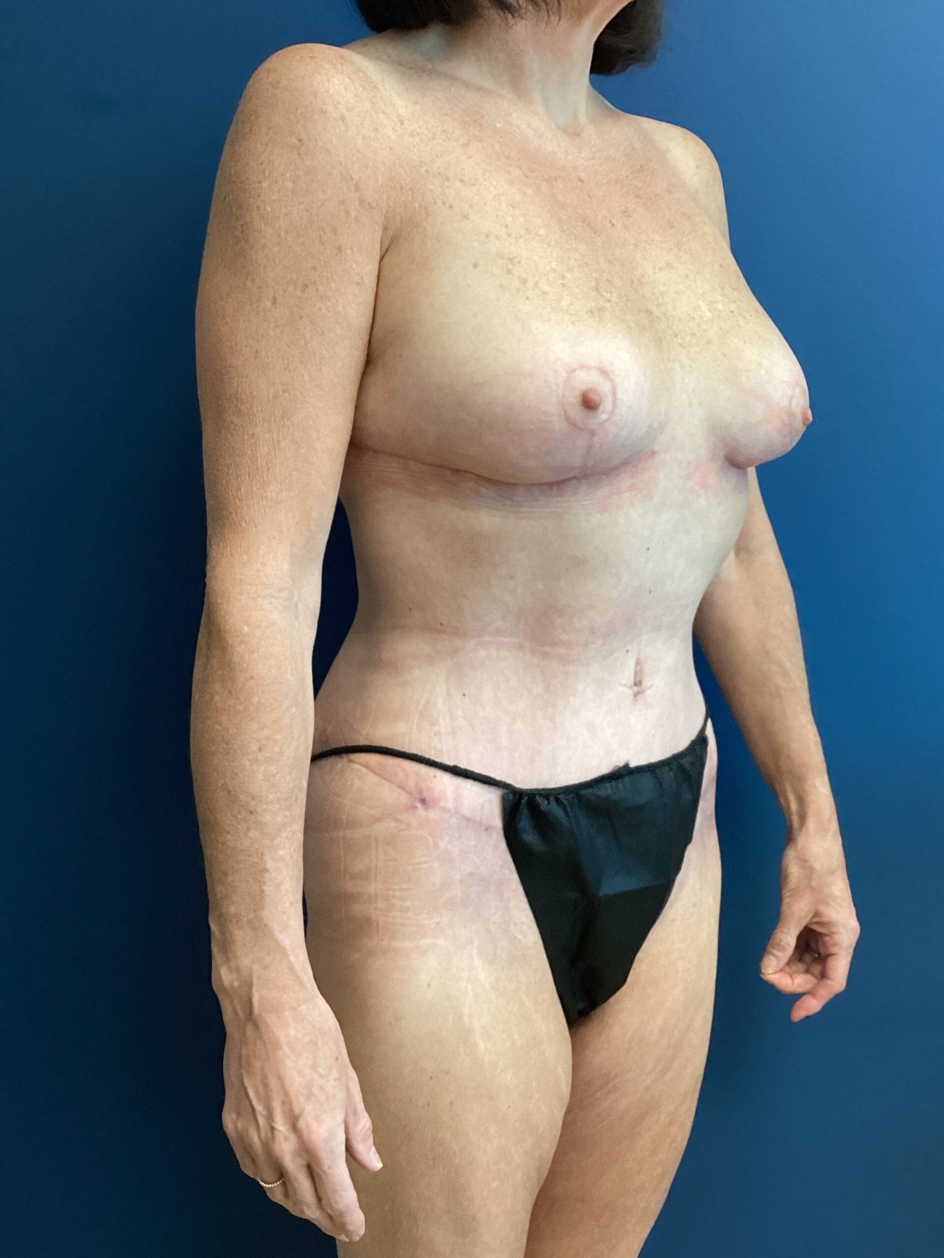 03.05.2025.EAK.MM.After_4