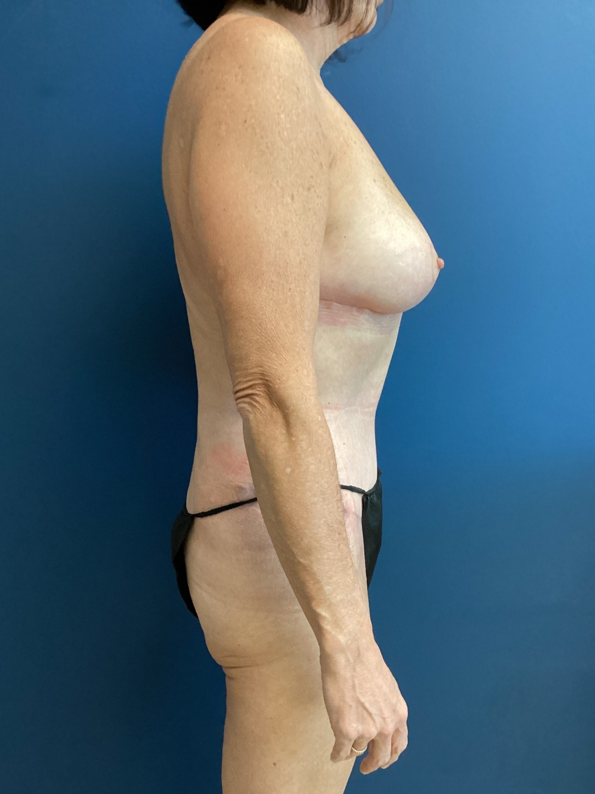 03.05.2025.EAK.MM.After_5