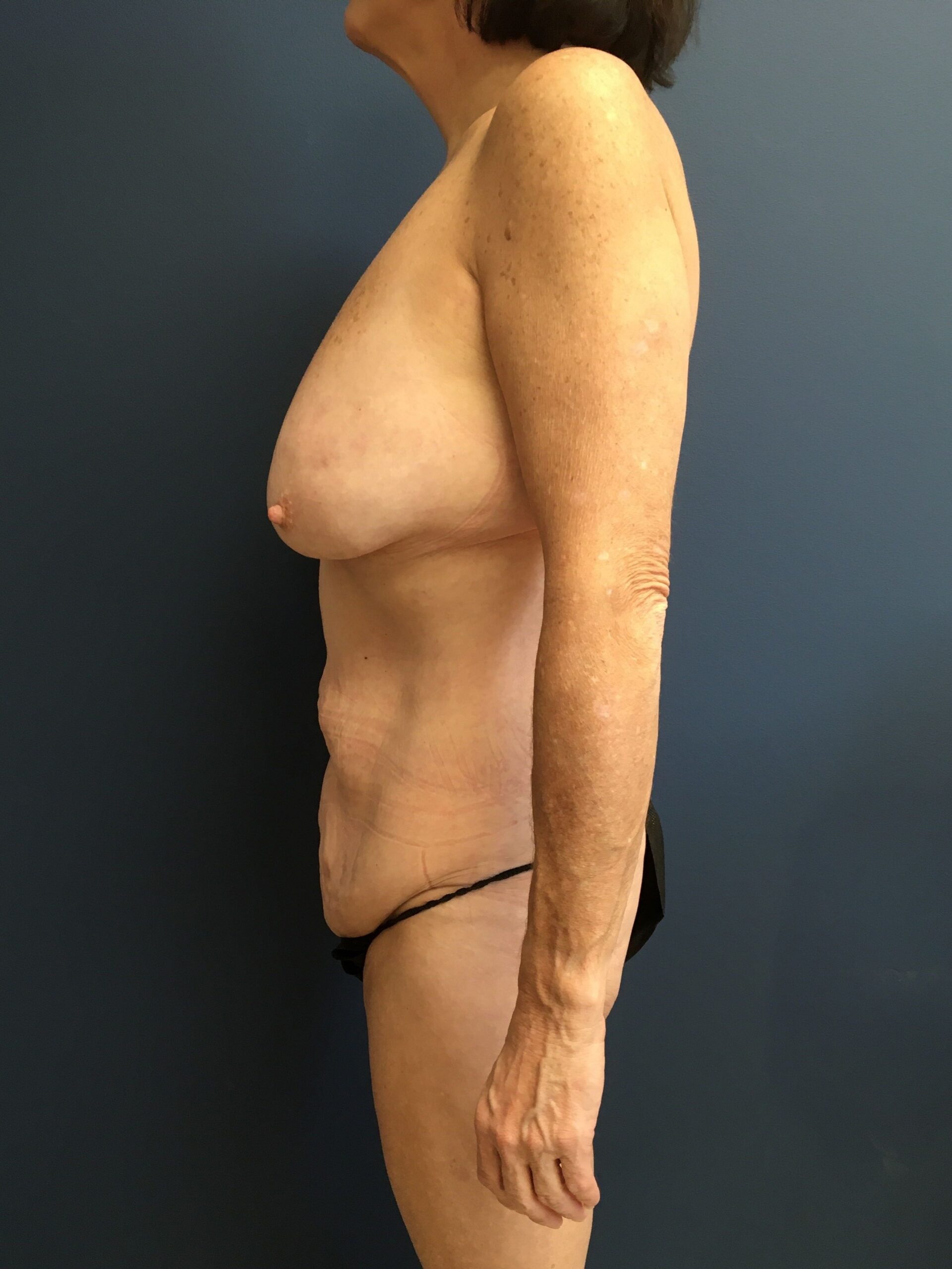 7.17.24_EAK_MM_After (4)