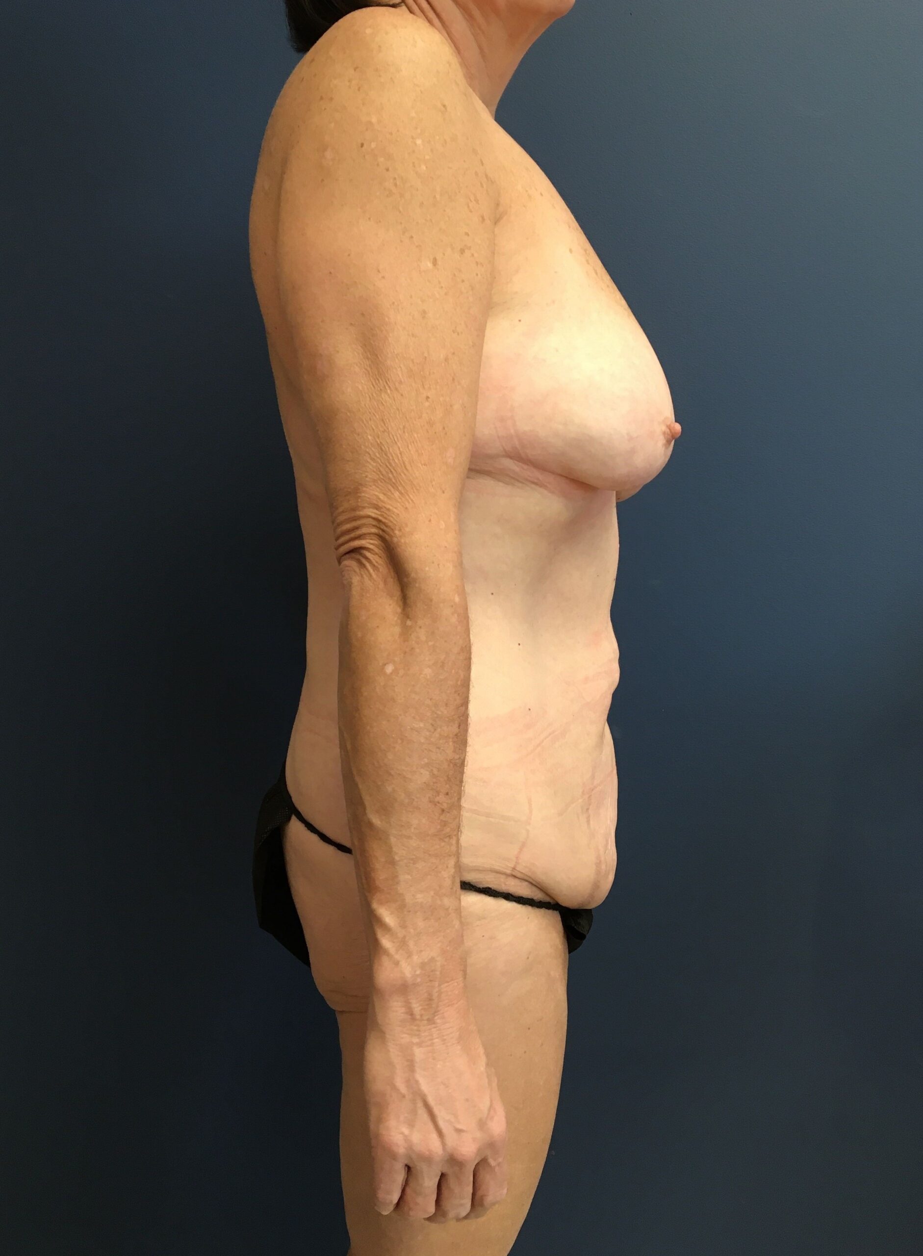 7.17.24_EAK_MM_After (4)