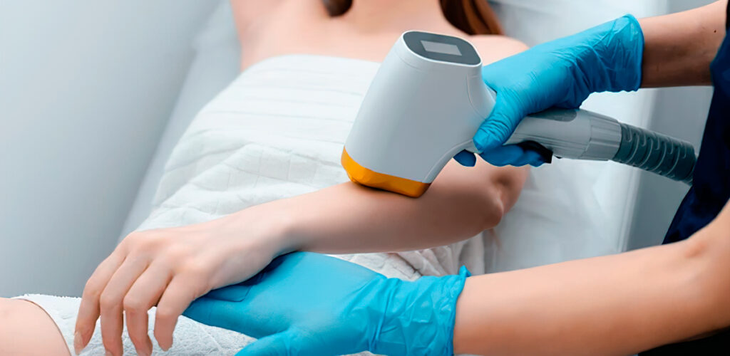 Laser-Hair-Removal