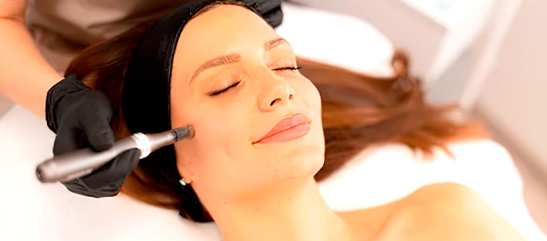Radiofrequency-Microneedling