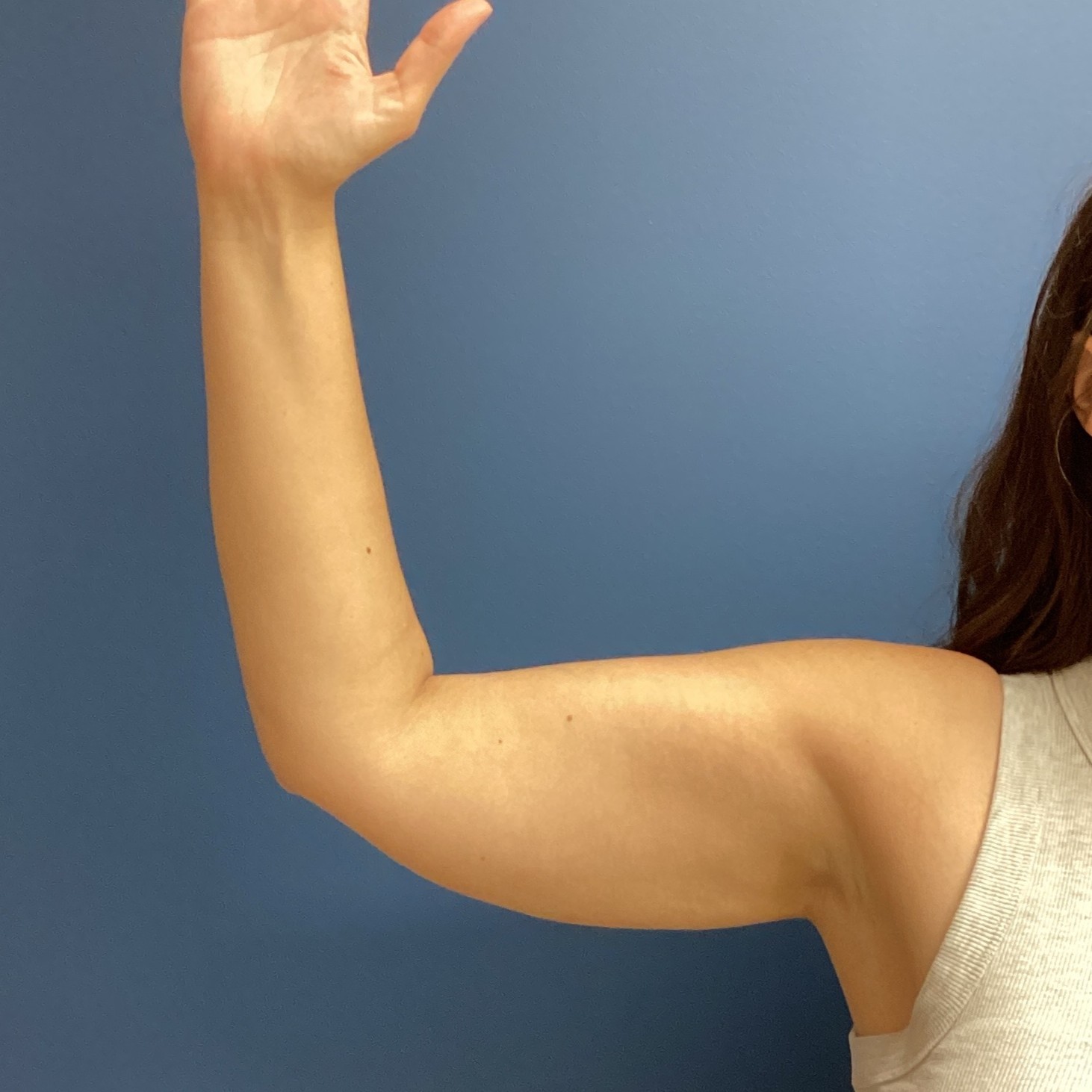 JDS_ARM_KS_6.13.25_AFTER7