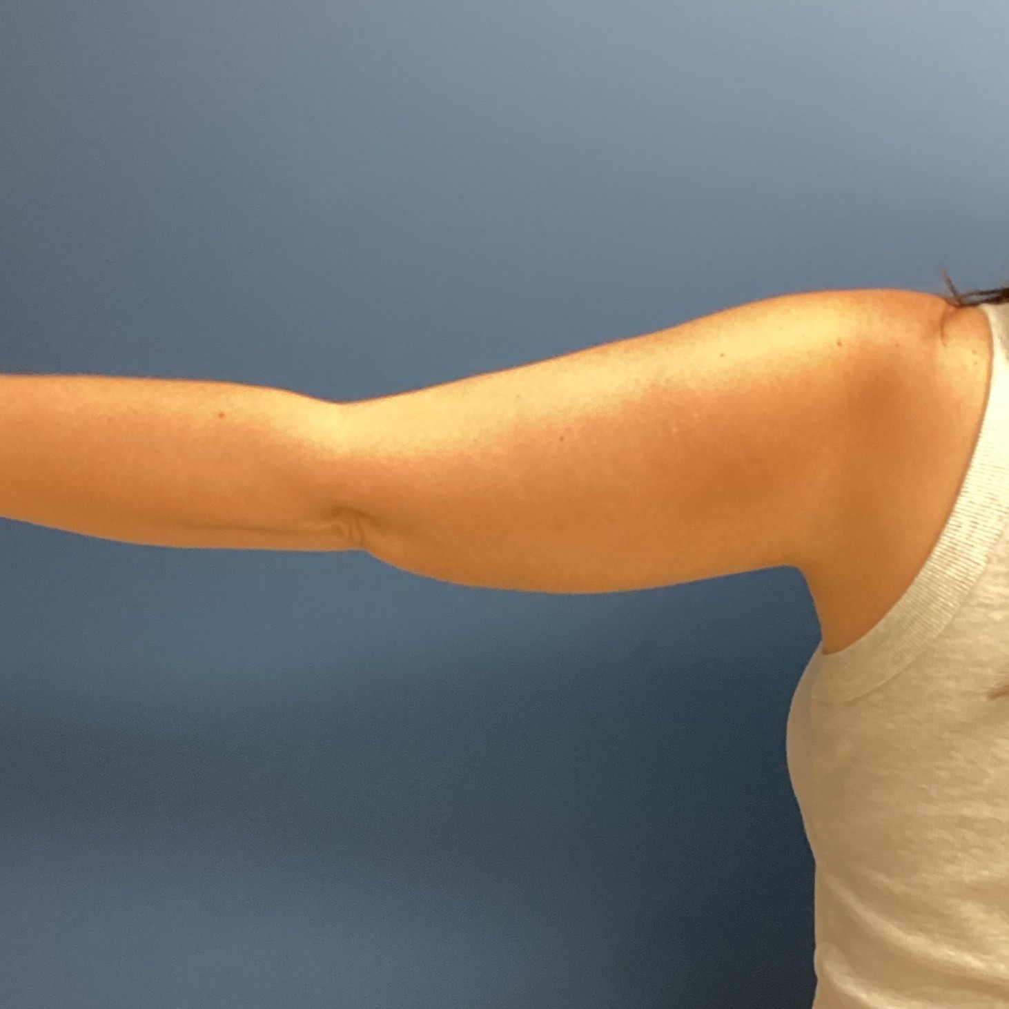 JDS_ARM_KS_6.13.25_AFTER7