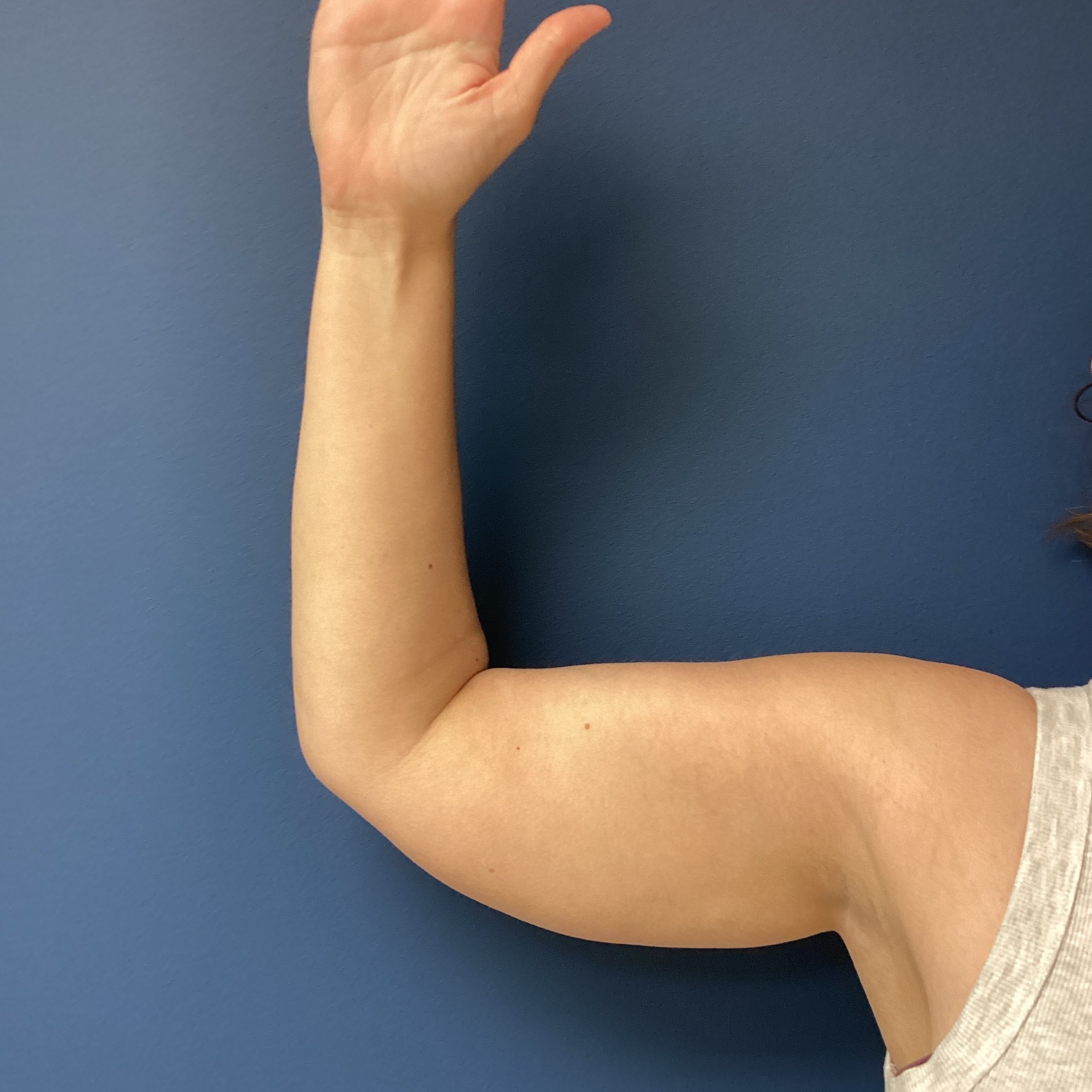 JDS_ARM_KS_6.13.25_BEFORE1