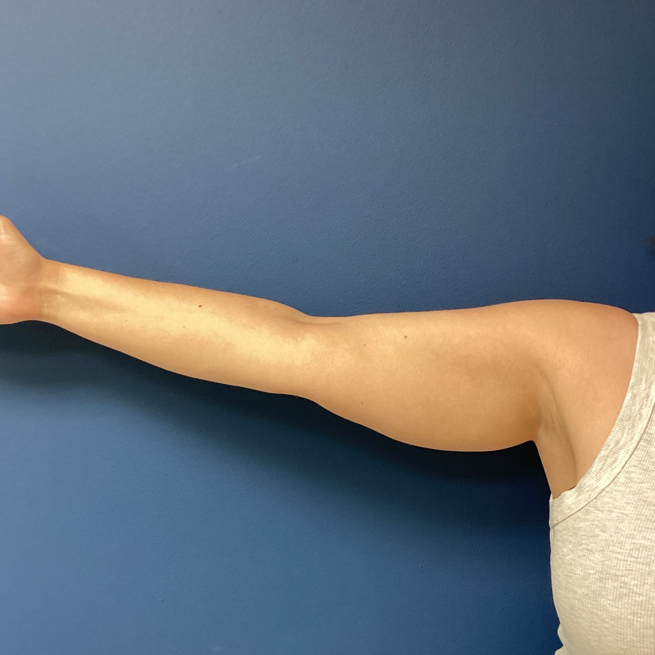 JDS_ARM_KS_6.13.25_BEFORE2