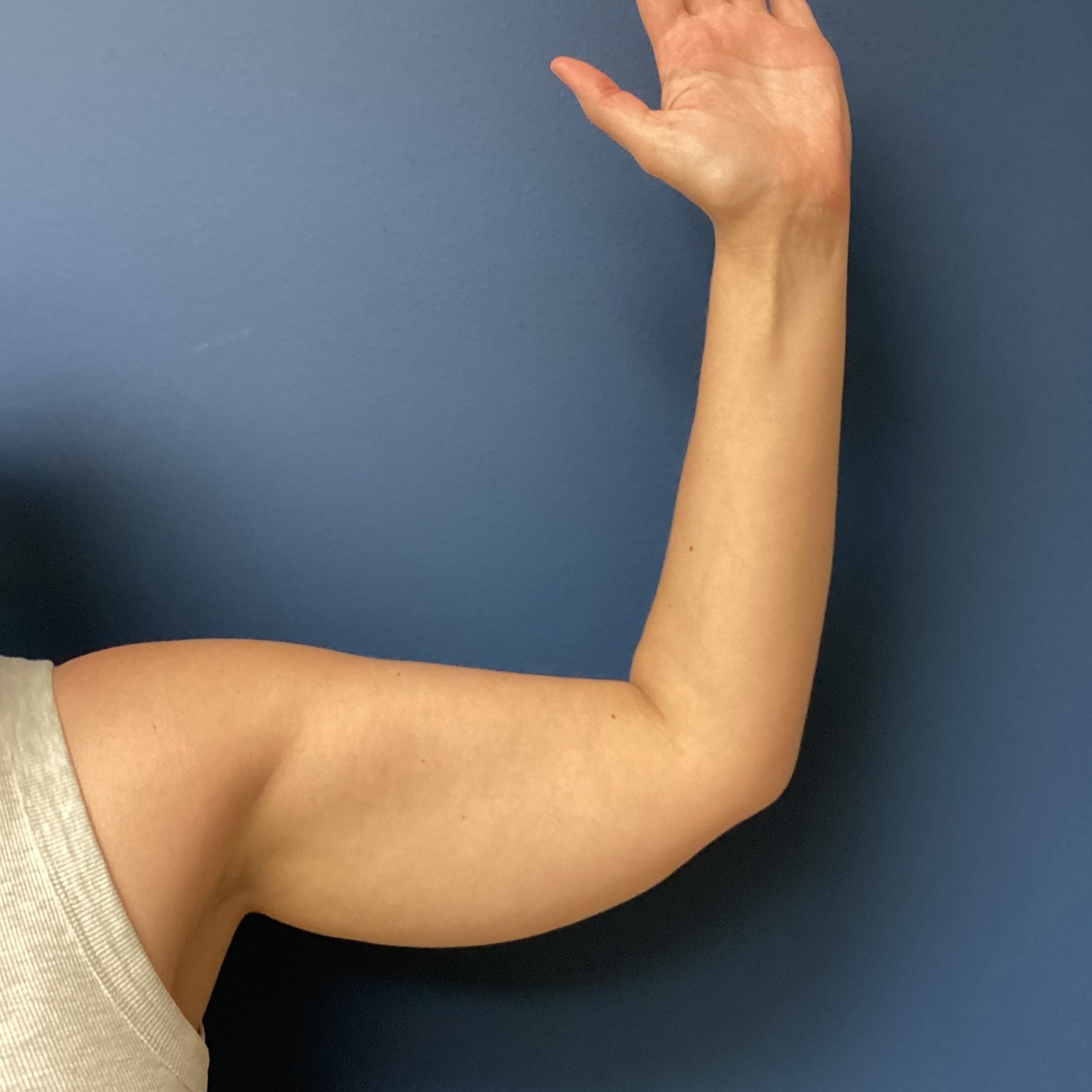 JDS_ARM_KS_6.13.25_BEFORE3