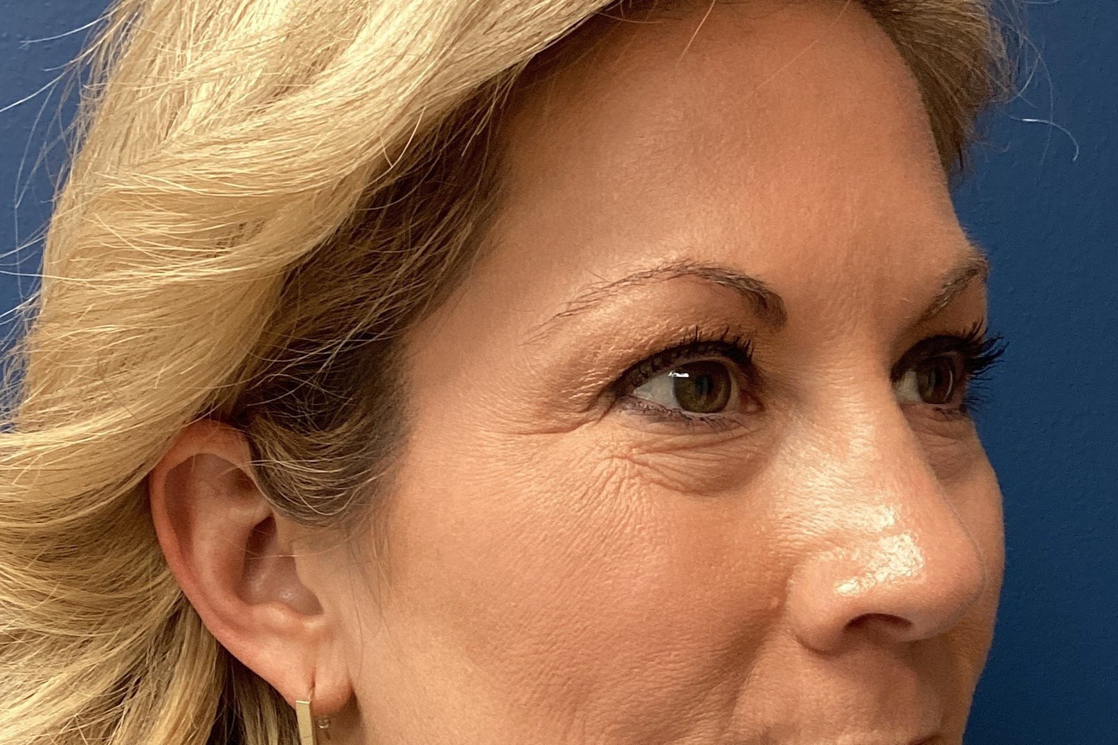 06.05.2025.EAK.BAM.Pexy.After_4