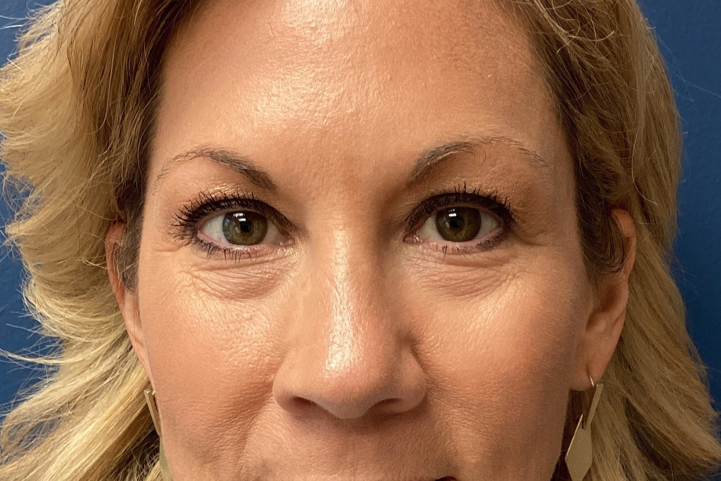 06.05.2025.EAK.BAM.Pexy.After_4