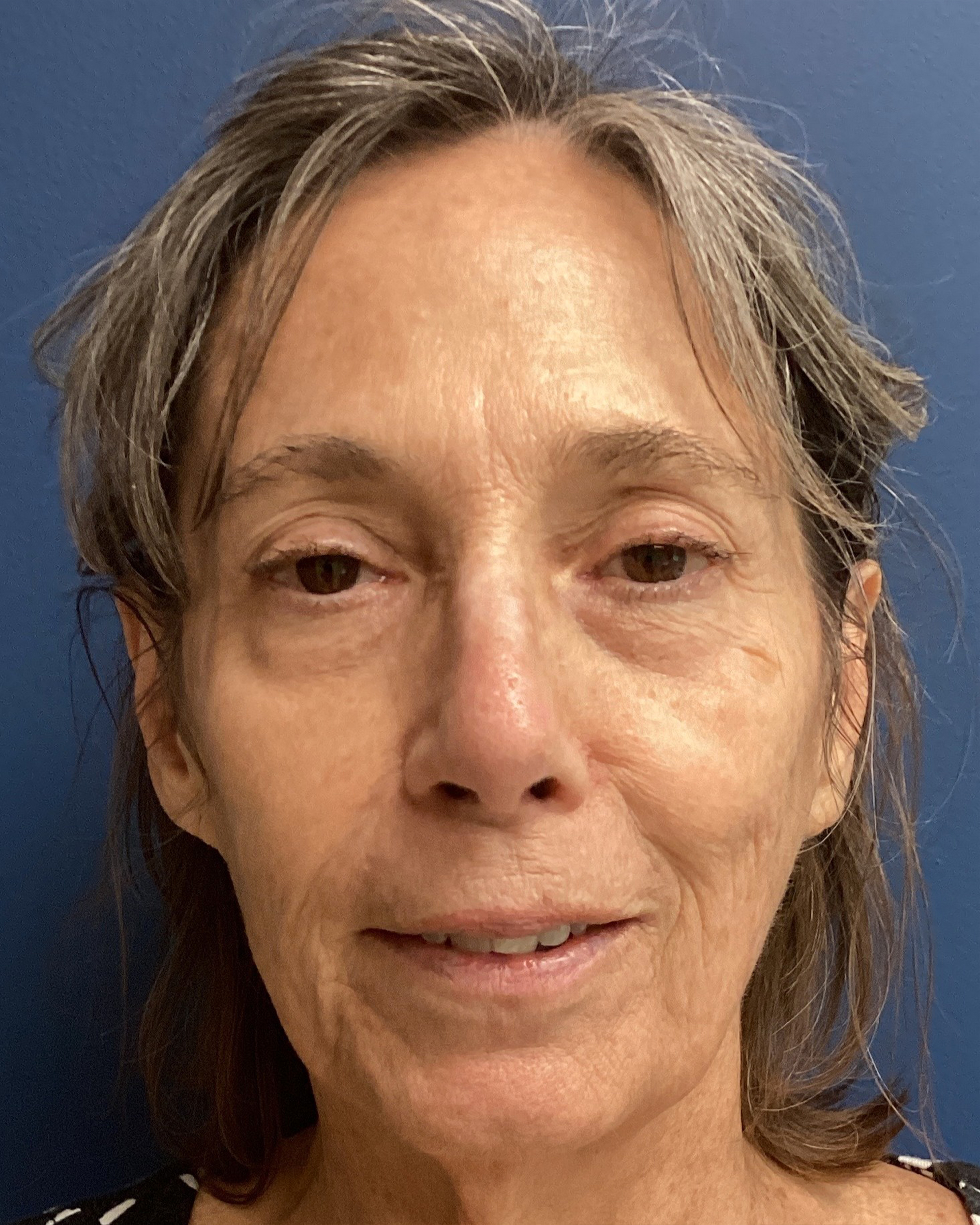 JDS_RHINO_BP_10.28.24_AFTER2