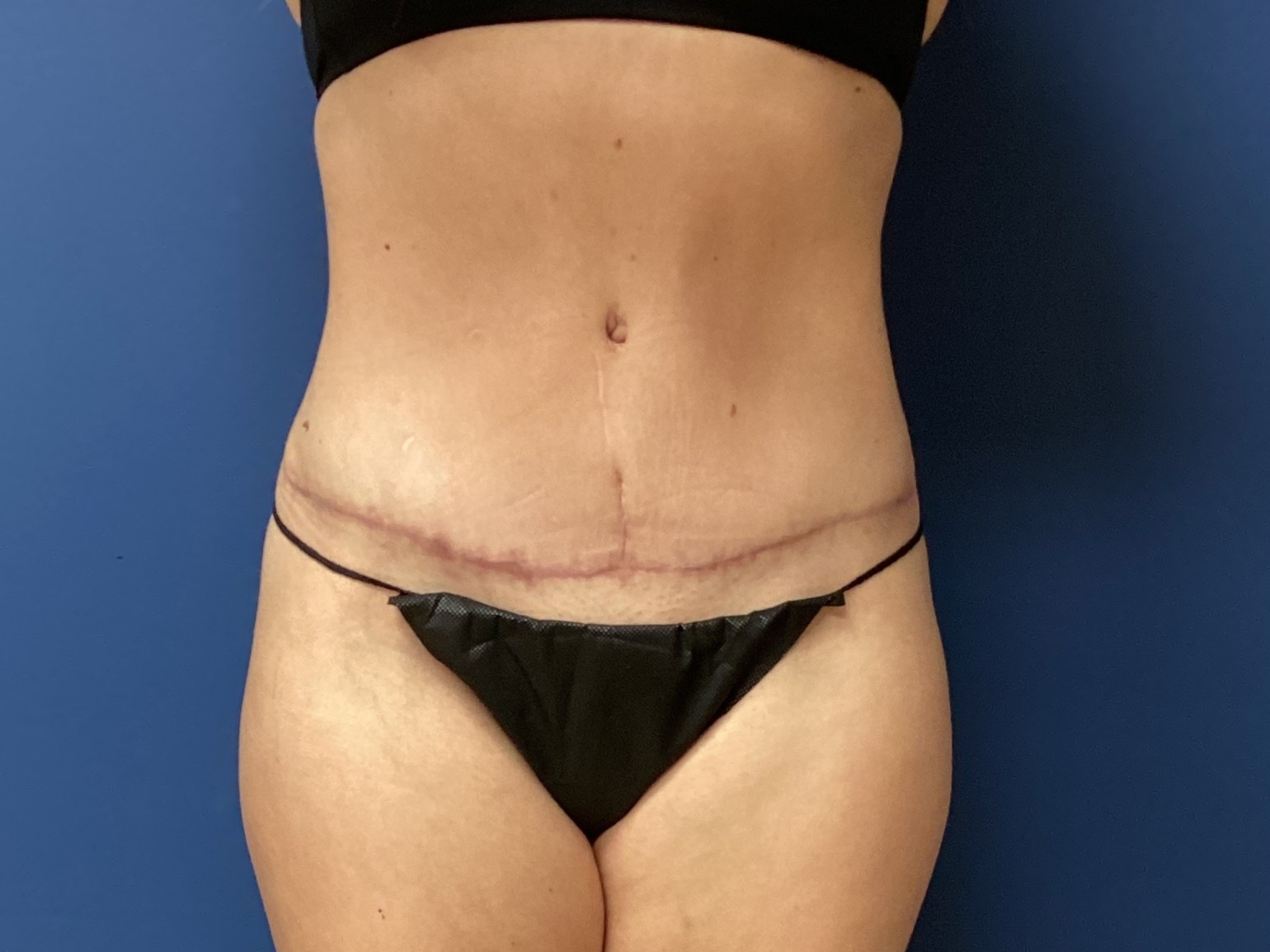 JDS_ABD_KW_9.18.25_AFTER1