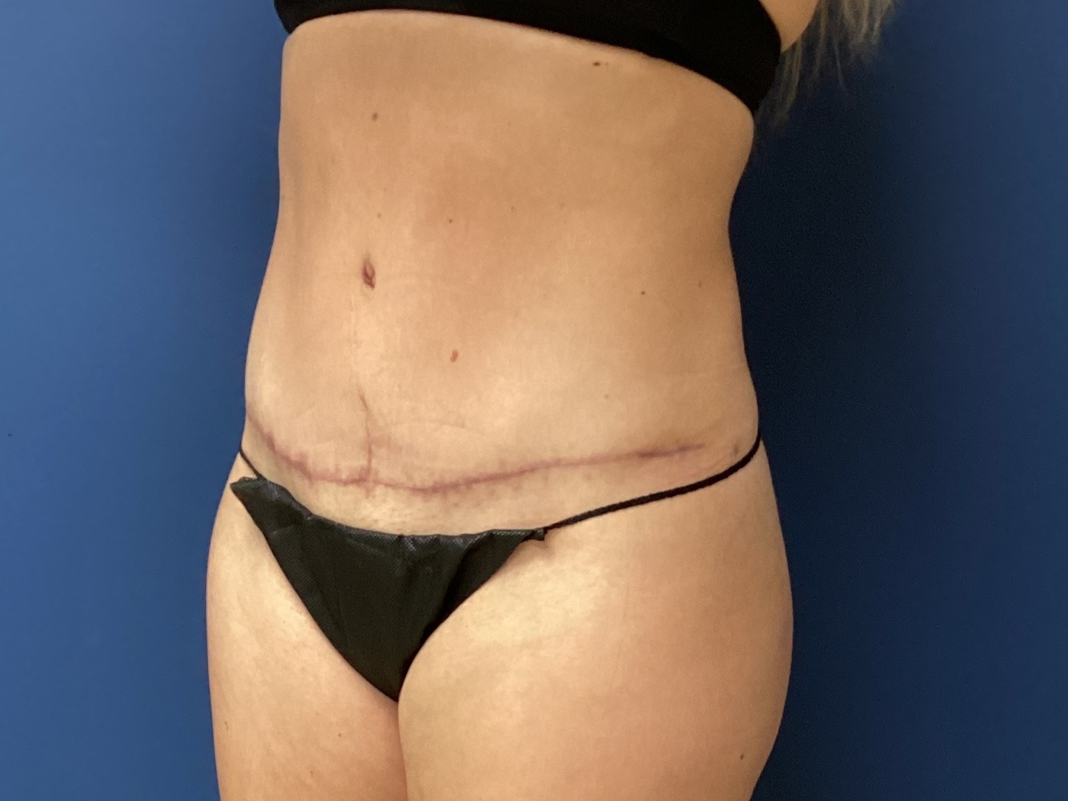 JDS_ABD_KW_9.18.25_AFTER2