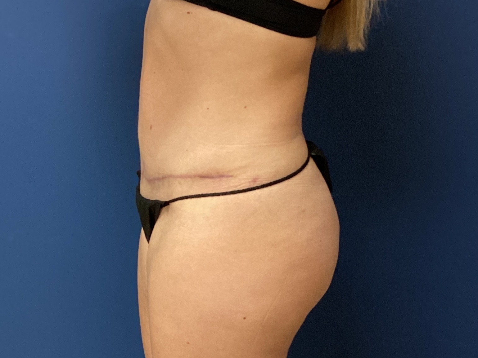 JDS_ABD_KW_9.18.25_AFTER3