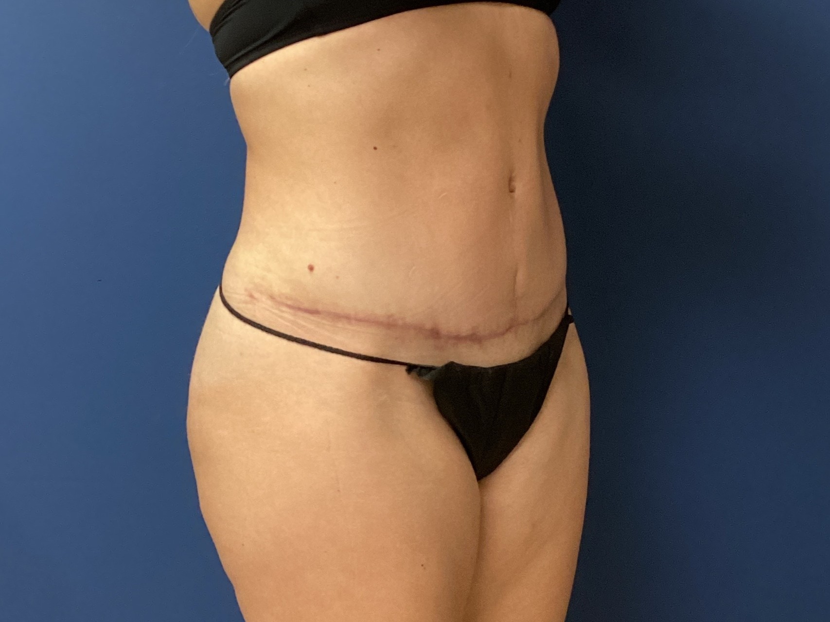 JDS_ABD_KW_9.18.25_AFTER4