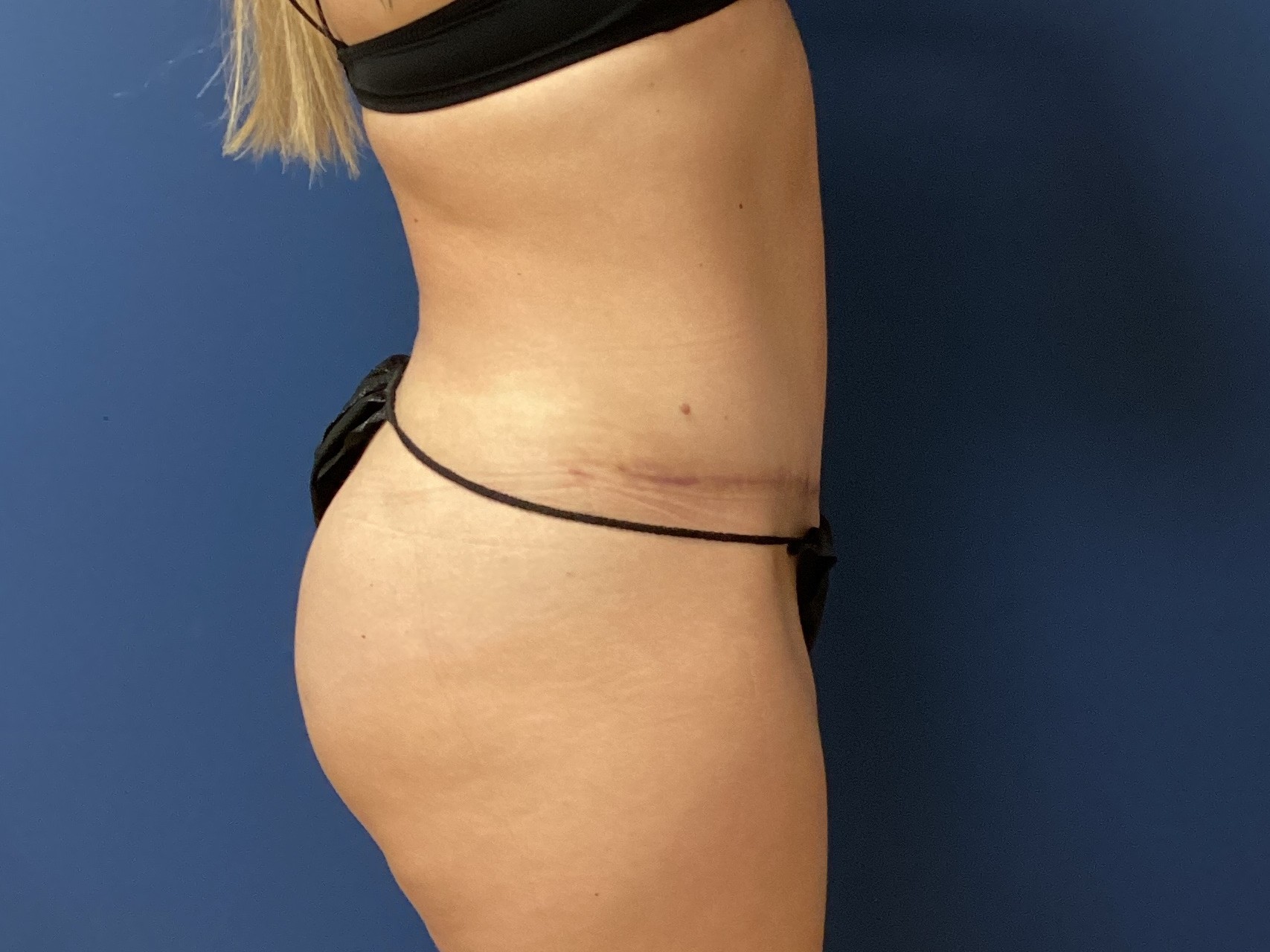 JDS_ABD_KW_9.18.25_AFTER5