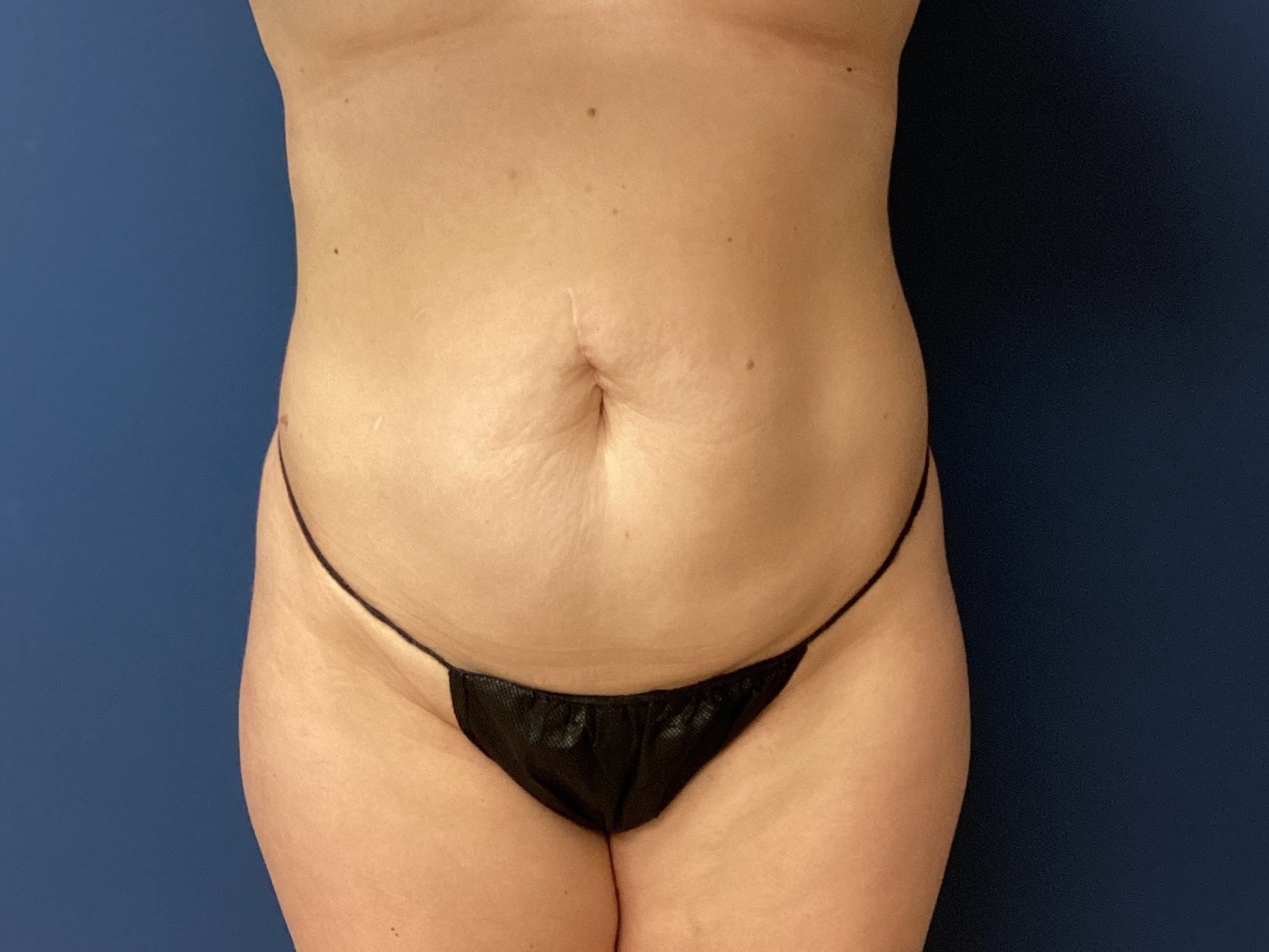 JDS_ABD_KW_9.18.25_BEFORE1