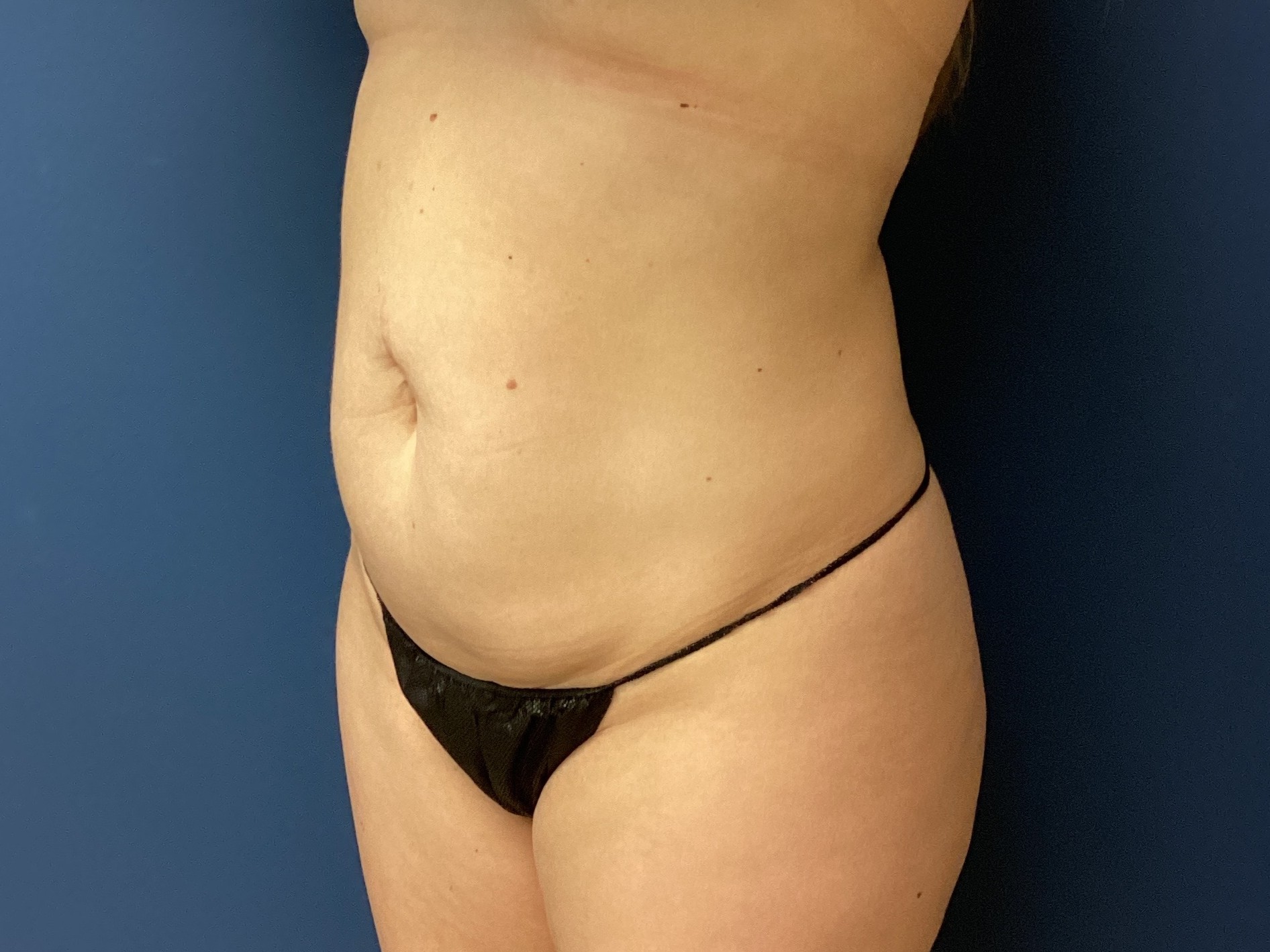 JDS_ABD_KW_9.18.25_BEFORE2