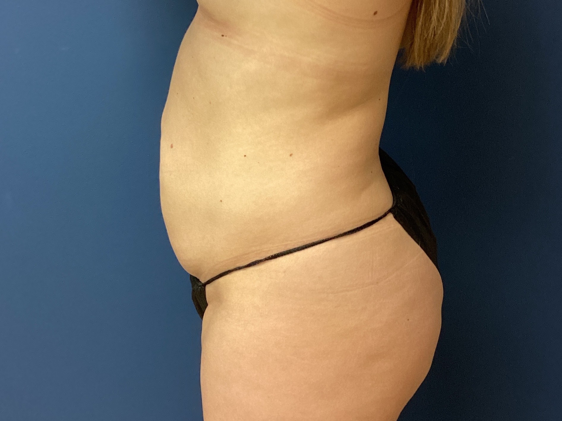 JDS_ABD_KW_9.18.25_BEFORE3