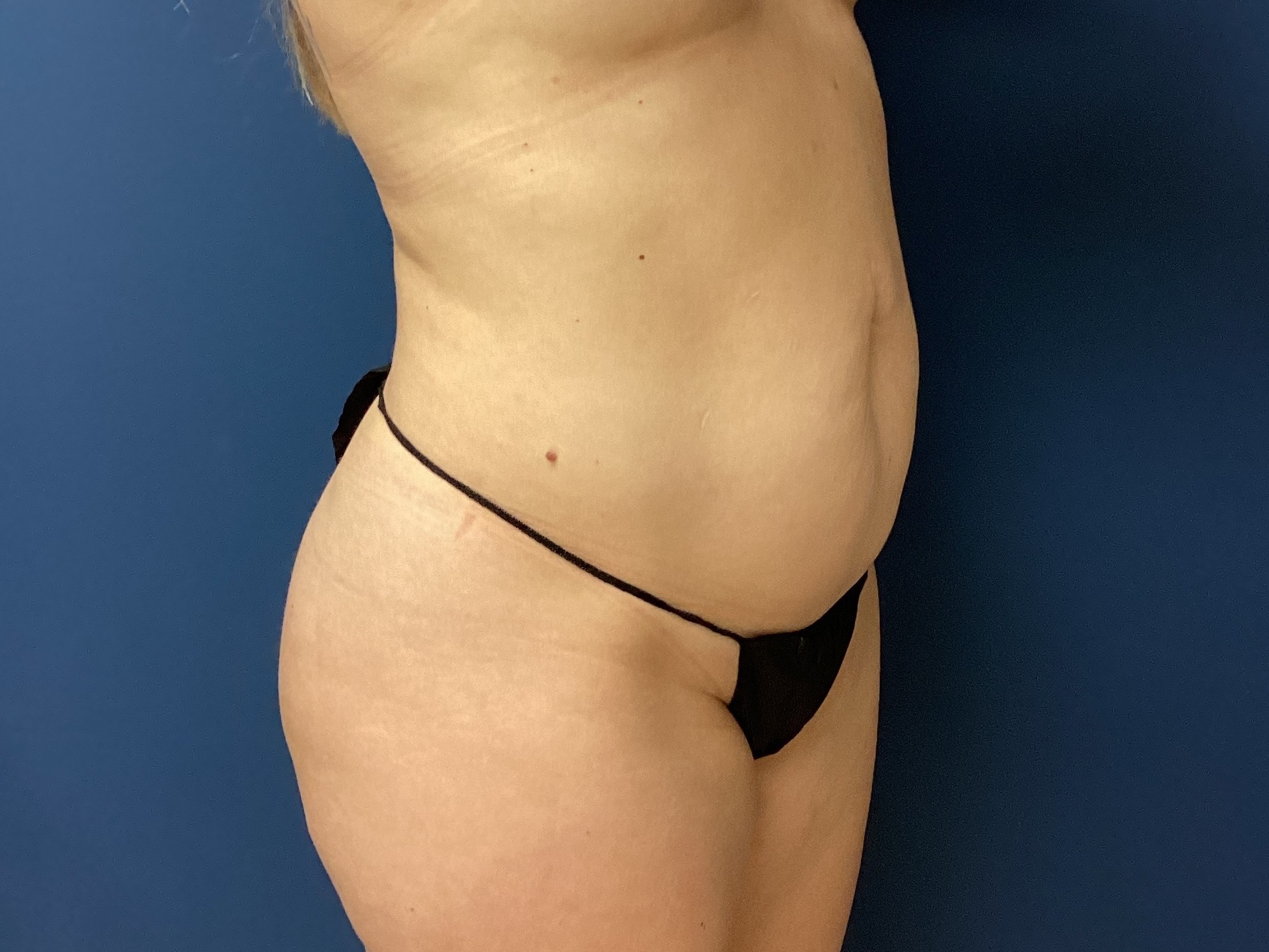 JDS_ABD_KW_9.18.25_BEFORE4