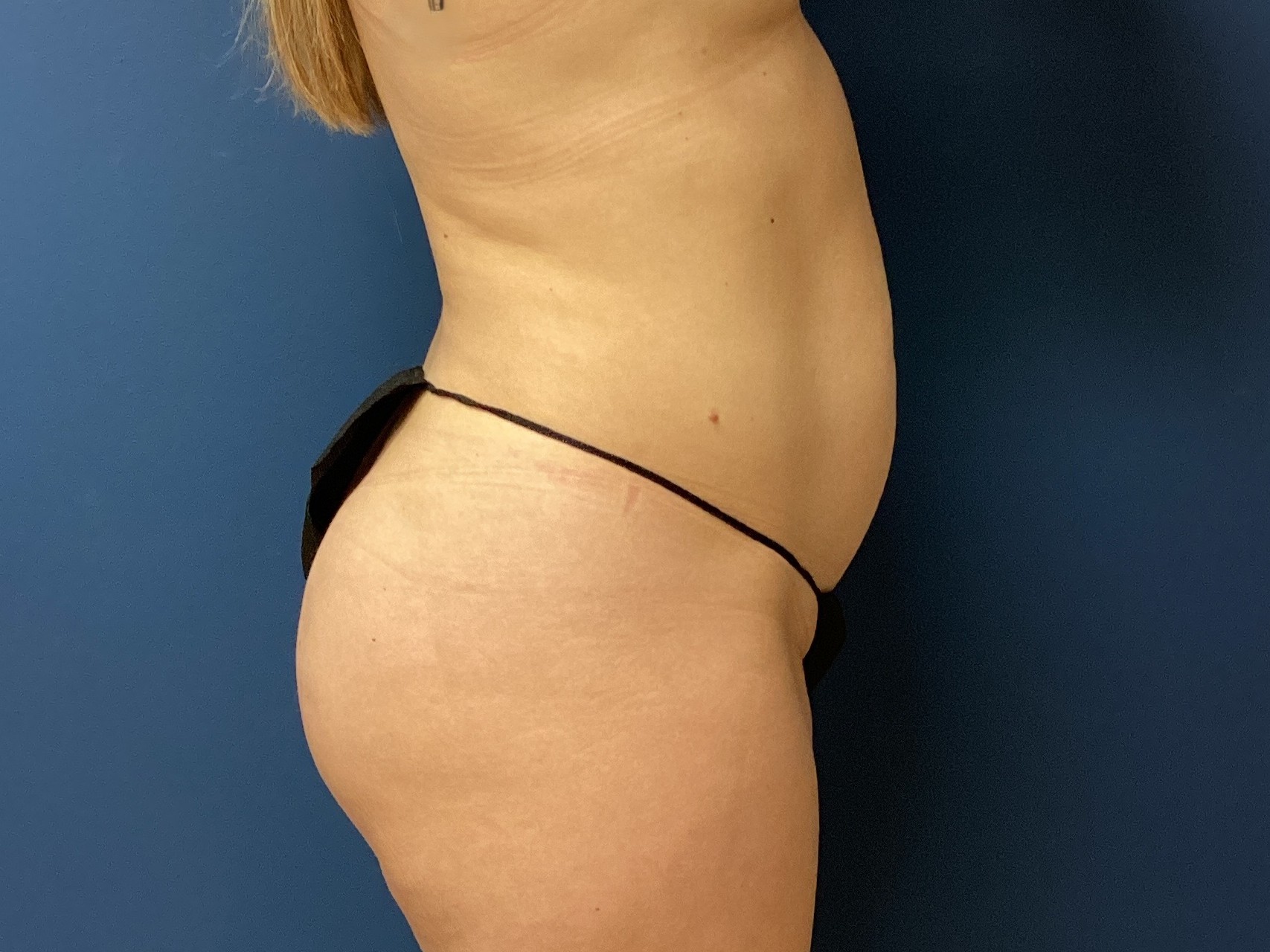 JDS_ABD_KW_9.18.25_BEFORE5