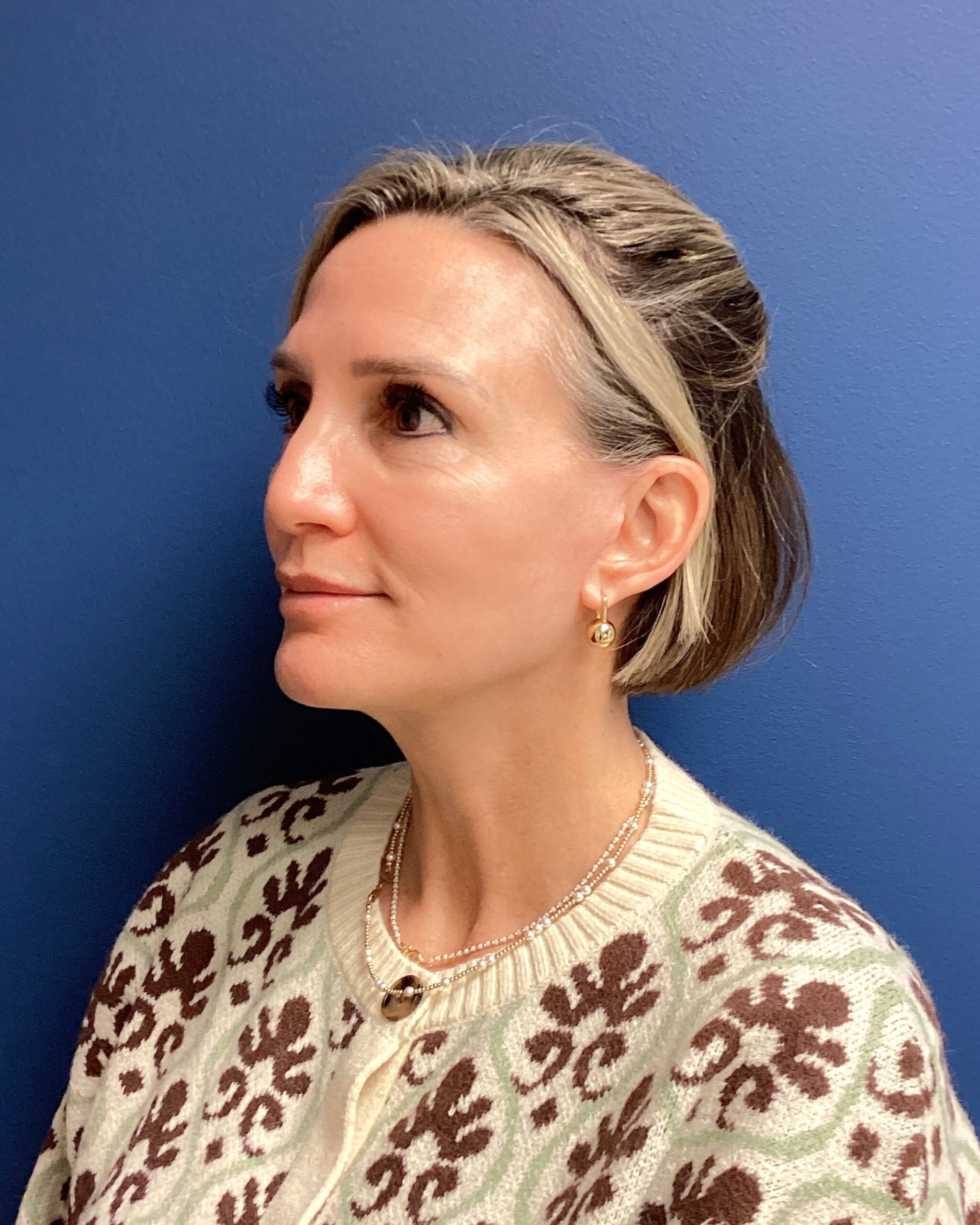 SLY-RHYTID SX 10.7.25 after 3