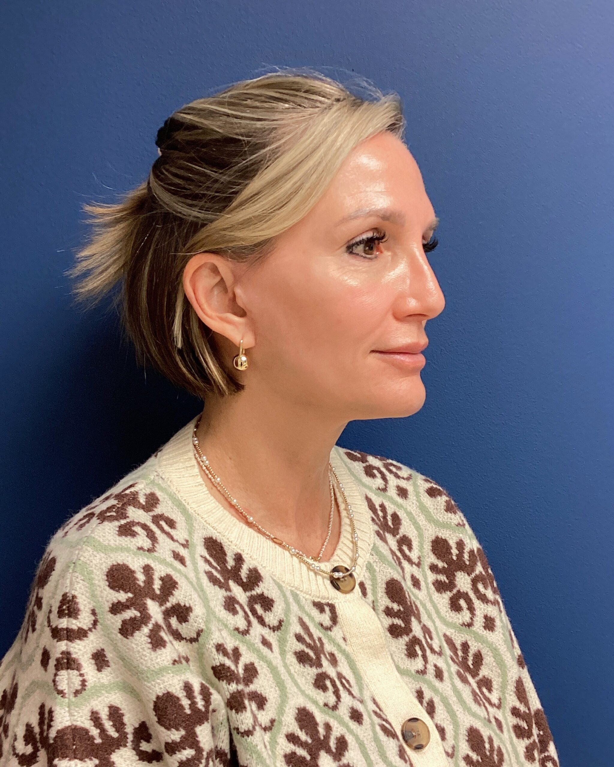 SLY-RHYTID SX 10.7.25 after 5