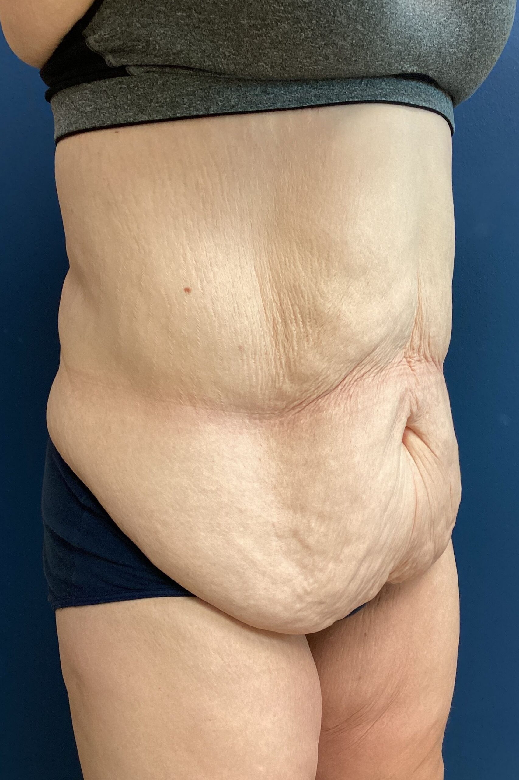 EAK.1.17.2024. FDL.Before_2