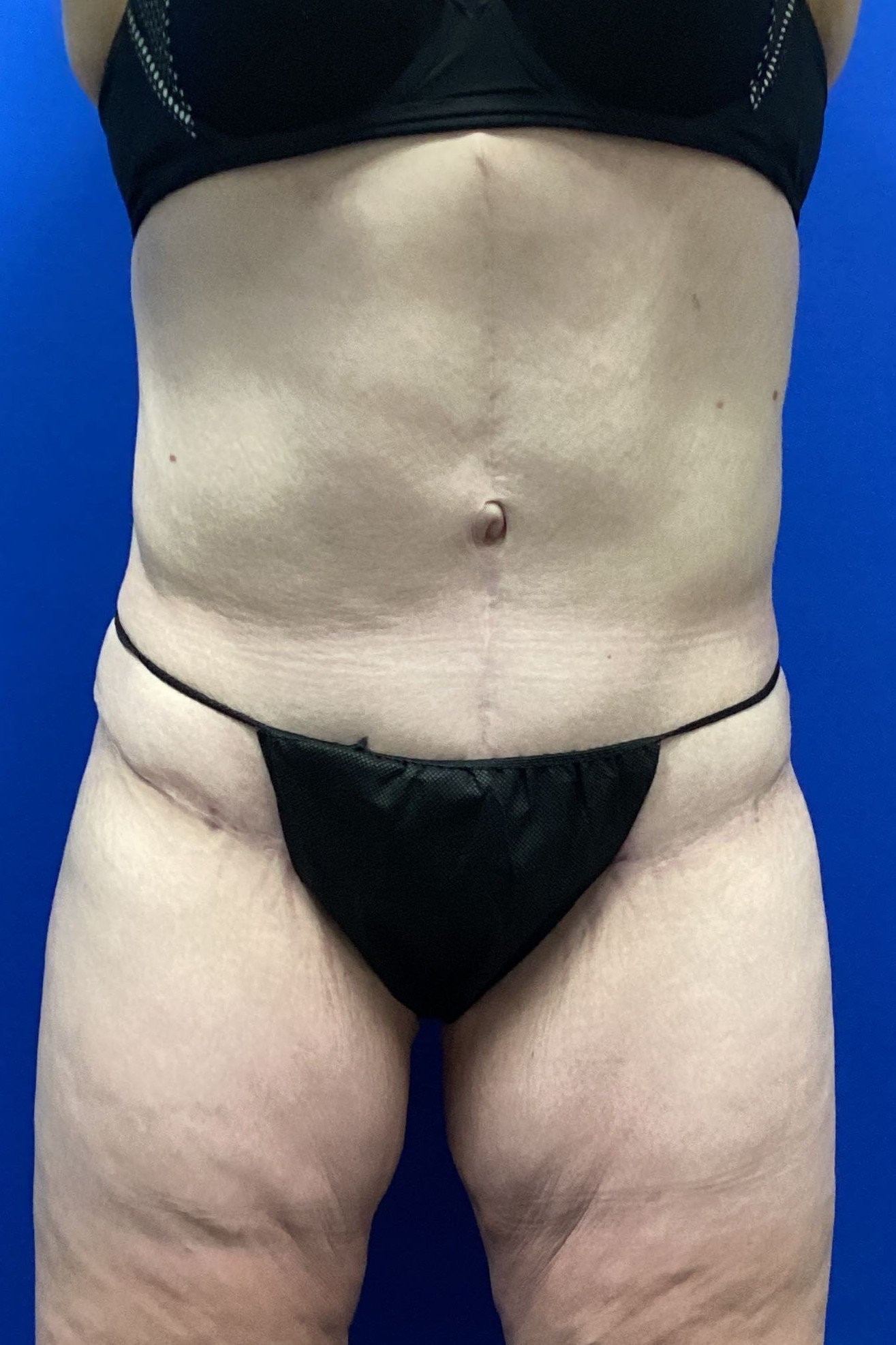 EAK.1.17.2024.FDL.FDL.After_1