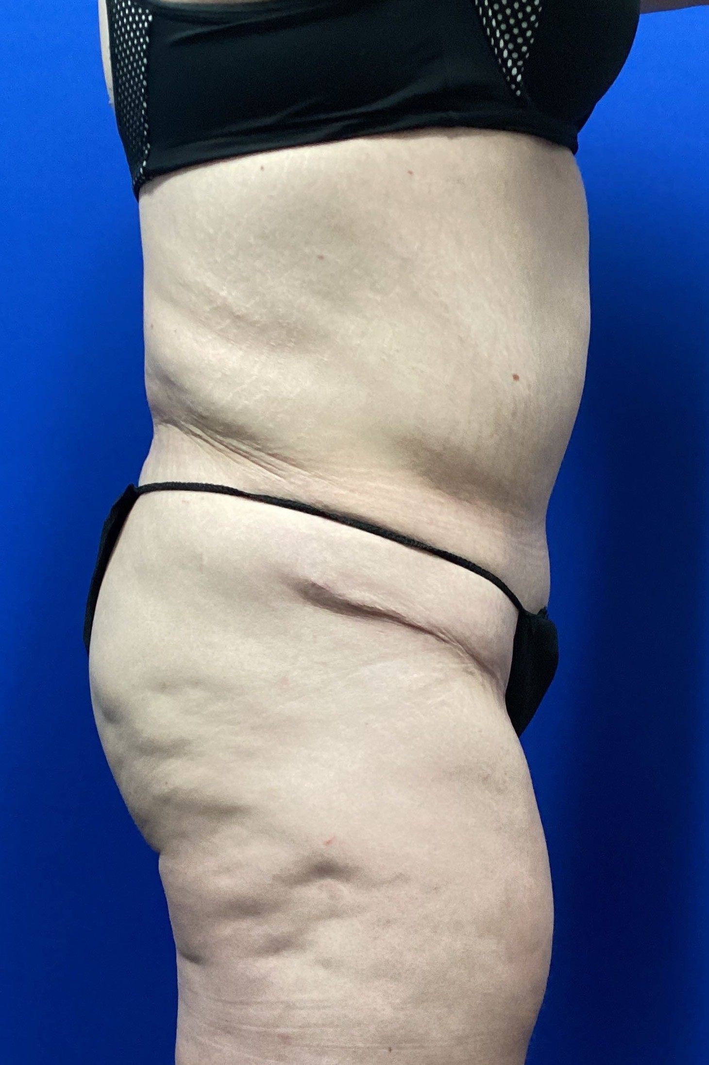 EAK.1.17.2024.FDL.FDL.After_3