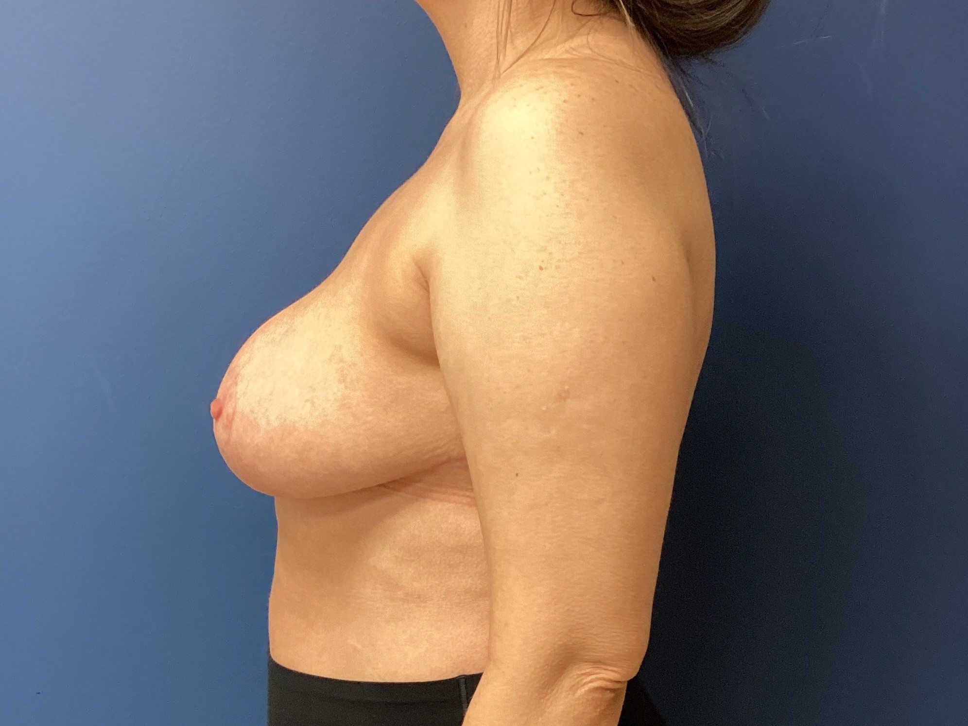 JDS_BRM_CH_11.5.25_AFTER3