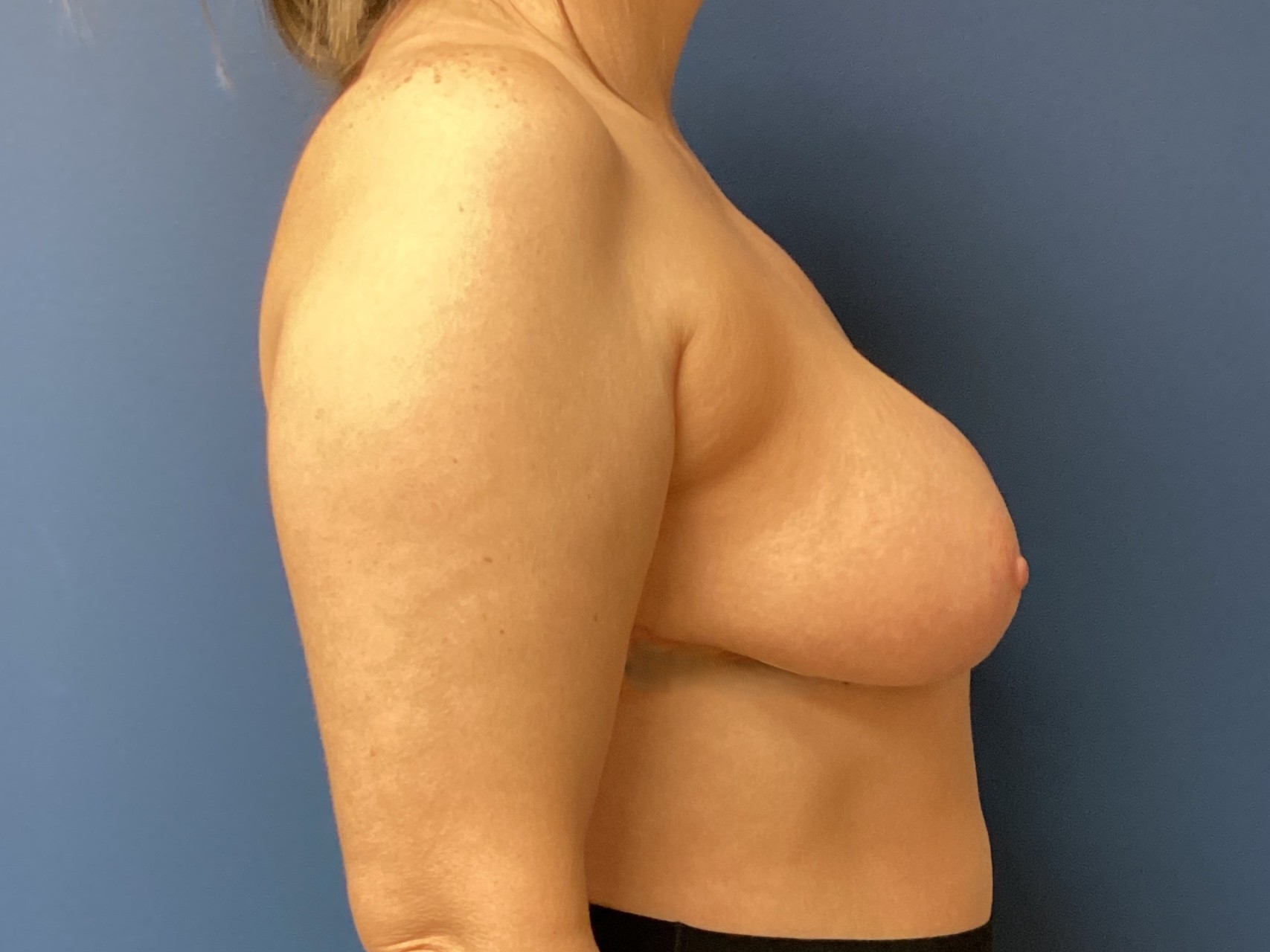 JDS_BRM_CH_11.5.25_AFTER5